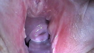 Jizm Insertion with Injection needle in Cervix Utherus after Romping