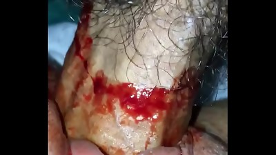 Bloody Internal ejaculation