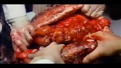 Devil Fetus 2 (1984) One Of Hong Kong'_s Most Notorious And Disgusting Black Magic Horror Videos